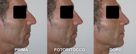 fotoritocco-naso-uomo