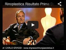 Video: Il risultato Prima e Dopo l’Intervento di Rinoplastica